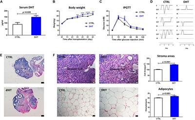 Inhibition of Col6a5 Improve Lipid Metabolism Disorder in Dihydrotestosterone-Induced Hyperandrogenic Mice